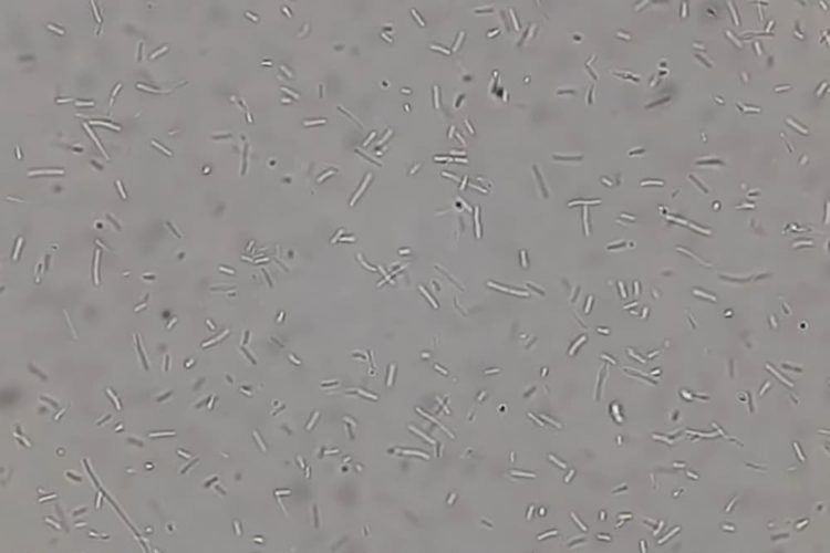 What Can I Put in My Humidifier to Kill Bacteria?