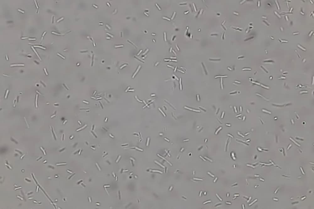 bacteria in humidifier